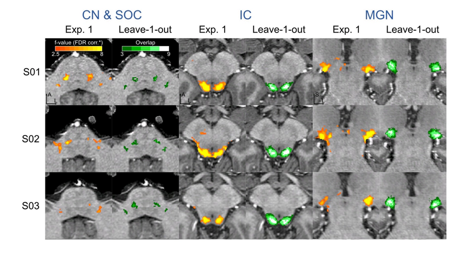 Sounds Classification in the Brainstem