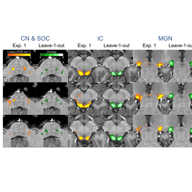 Sounds Classification in the Brainstem